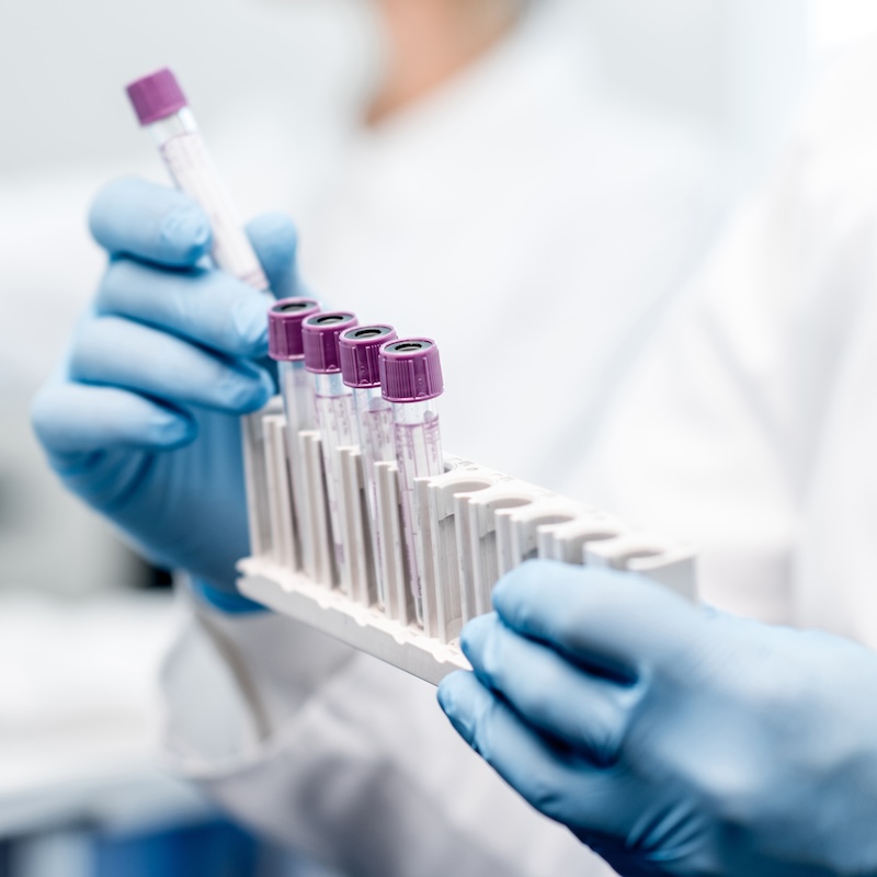 Lab testing that goes beyond the numbers, helping you understand what’s happening in your body and guide your care.<br> <a href="https://resoluteintegrativehealth.com/services/laboratory-services/" class="single-btn">Learn More</a>
